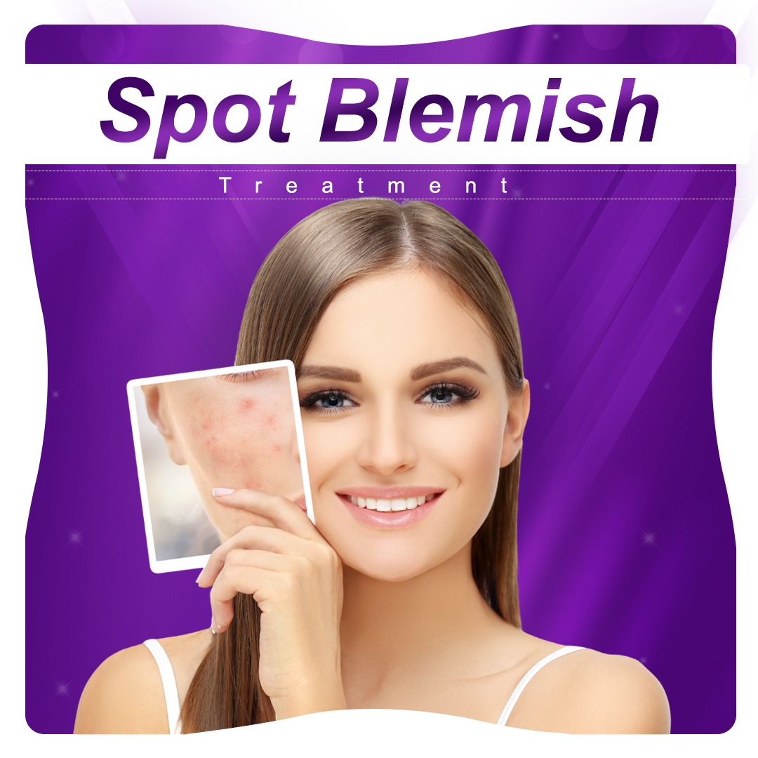skin types