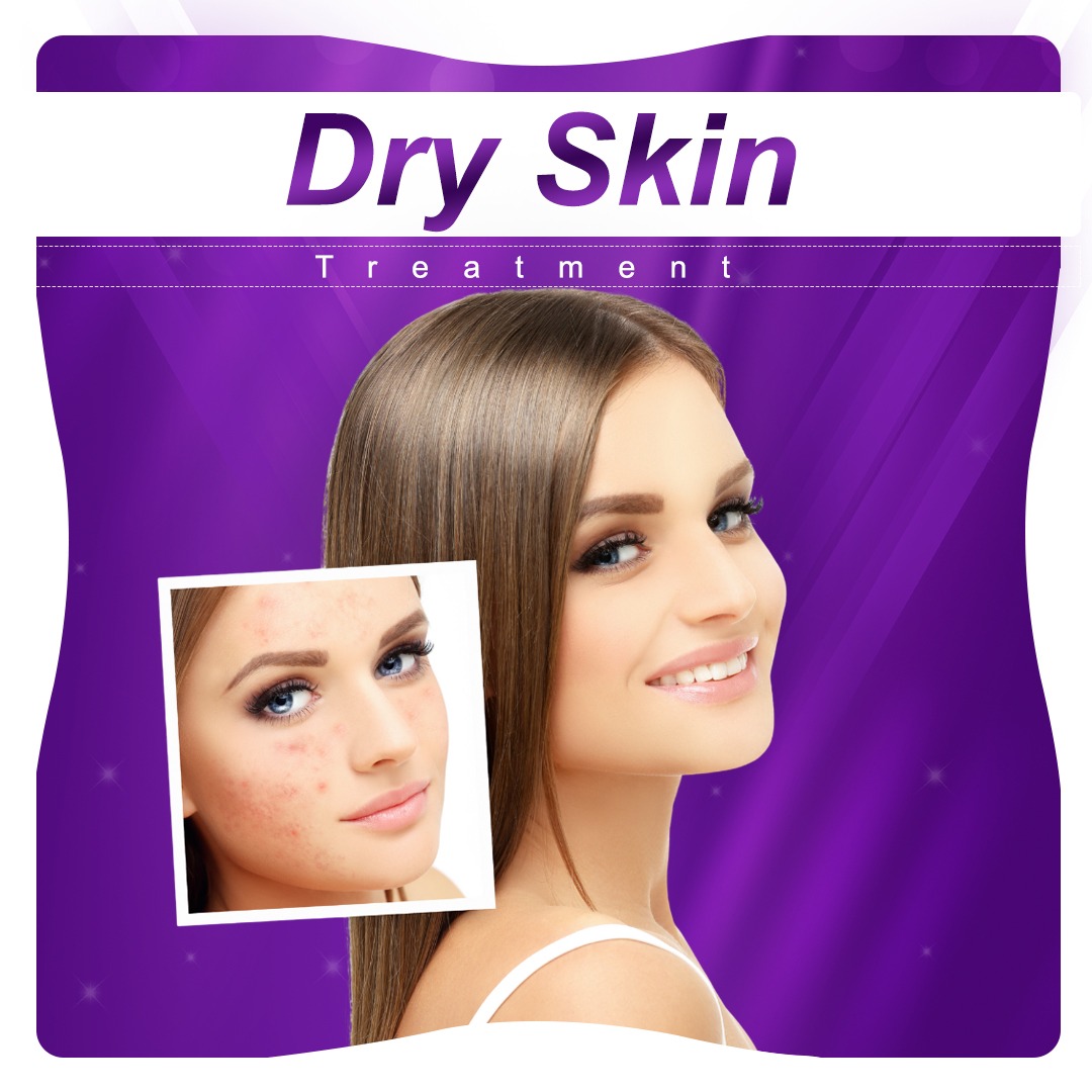 skin types