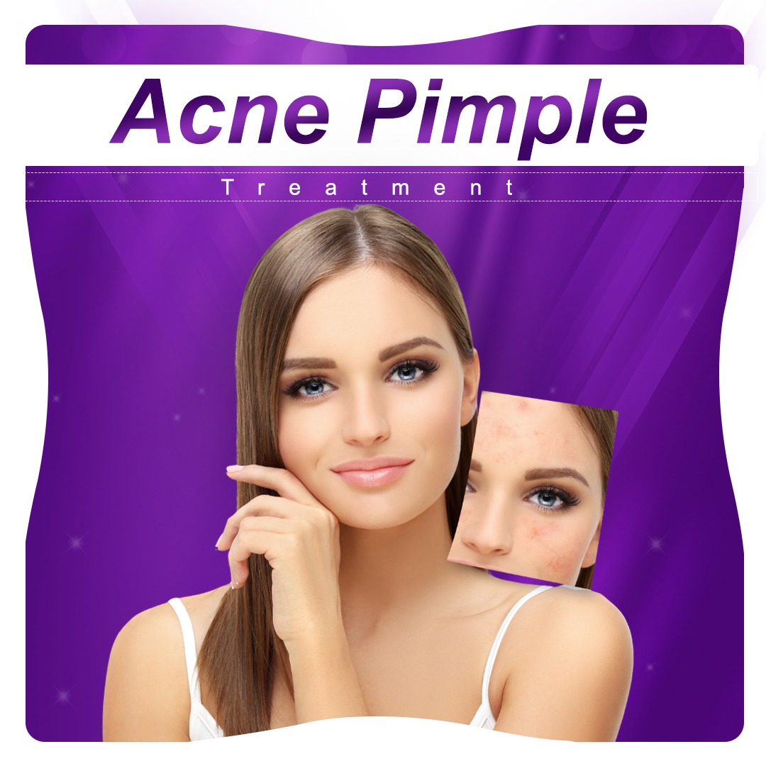 skin types